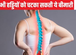 आपकी जिंदगी से कई साल छीन लेगी हड्डियों की यह साइलेंट बीमारी, बोन फ्रेक्चर से बचने के ये हैं उपाय