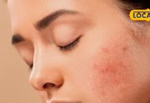 चांद की तरह चमकेगा चेहरा! इन देसी नुस्खों से पाएं बेदाग और ग्लोइंग स्किन