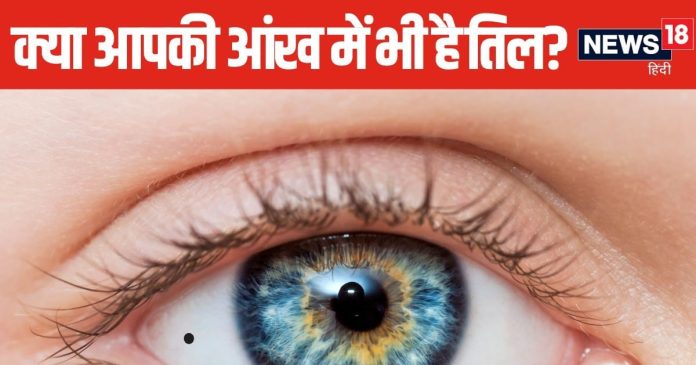 बहुत भाग्यशाली होते हैं ऐसे लोग जिनकी आंख की पुतली