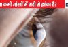 आपकी नशीली आंखों में सिर्फ पर्सनैलिटी ही नहीं 5 बड़ी बीमारियों के राज भी होते हैं छिपे, क्या कभी किया है गौर? आज ही देख लीजिए