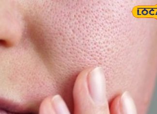 Dry Skin Tips: ड्राई स्किन वाले सर्दियों में चेहरे पर लगाए ये चीजें, त्वचा हमेशा रहेगी हेल्दी, जानें एक्सपर्ट से