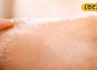 सर्दी में नहीं फटेंगी एड़ियां, दरारें तेजी से भरेंगी, रामबाण से कम नहीं ये उपाय