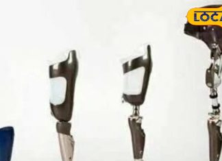 Artificial Organ: दिव्यांगों के लिए सुनहरा अवसर, यहां शिविर में नि:शुल्क मिलेगा कृत्रिम अंग, लायंस क्लब की अनोखी पहल