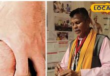 जड़ी-बूटियों से भी गठिया रोग का इलाज संभव, एक्सपर्ट से जानें उपचार का तरीका