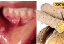 गुणों की खान है ये आयुर्वेदिक लकड़ी, मुंह के छाले से लेकर खासी तक के लिए कारगर