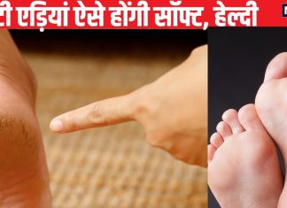 सर्दियों में बार-बार फट जाती हैं एड़ियां? इन 5 उपायों से पैर के तलवे होंगे सॉफ्ट, नहीं पड़ेगा पैरों को छुपाना
