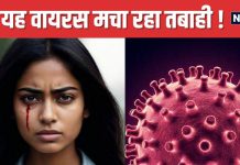 Bleeding Eye Virus: इस वायरस की चपेट में आने पर आंखों से बहता है खून ! अब तक 15 की मौत, 17 देशों में अलर्ट जारी