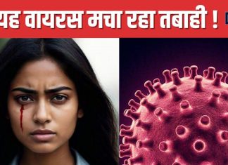 Bleeding Eye Virus: इस वायरस की चपेट में आने पर आंखों से बहता है खून ! अब तक 15 की मौत, 17 देशों में अलर्ट जारी