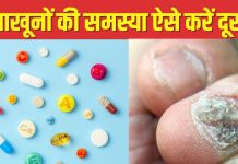 नाखून हो रहे हैं कमजोर और खराब? डाइट में शामिल कर लें 5 जरूरी विटामिन्स, नेल्स बनेंगे शाइनी और मजबूत