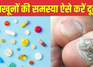 नाखून हो रहे हैं कमजोर और खराब? डाइट में शामिल कर लें 5 जरूरी विटामिन्स, नेल्स बनेंगे शाइनी और मजबूत