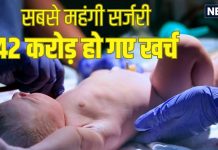 पैदा हुआ बैंगनी रंग का बच्चा, देखकर डॉक्टर भी घबरा गए, फिर करनी पड़ी सर्जरी, खर्च हो गए 42 करोड़