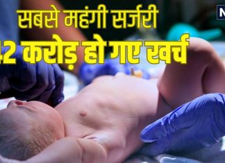 पैदा हुआ बैंगनी रंग का बच्चा, देखकर डॉक्टर भी घबरा गए, फिर करनी पड़ी सर्जरी, खर्च हो गए 42 करोड़