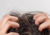 hair care tips home remedies dandruff treatment with natural ingredients sa