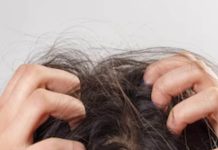 hair care tips home remedies dandruff treatment with natural ingredients sa