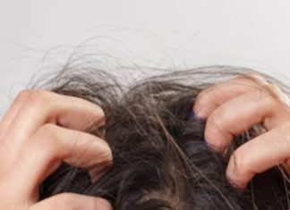 hair care tips home remedies dandruff treatment with natural ingredients sa