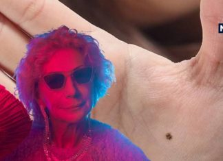 हथेली के इस हिस्से पर है तिल तो अमीर होगा शख्स, जानें आप अपना भी भविष्य