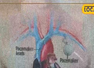 क्या ठंड के मौसम में खाना चाहिए हरी सब्जी, शरीर के लिए फायदेमंद या नुकसान?
