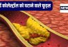 बस 1 महीने खाएं ये 8 फूड, बैड कोलेस्ट्रॉल का मिट जाएगा नामोनिशान, हानिकारक वसा पिघलते नहीं लगेगी देर, दिल रहेगा चंगा