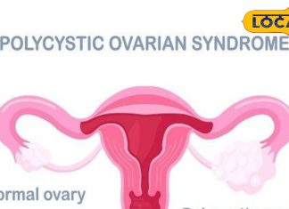 ये छोटी सी गलती आपको बना देगी बांझ, रुक जाएगा पीरियड, इस रोग की चपेट में हर पांच में से एक महिला