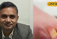 सर्दियों में होने वाली इस बीमारी को हल्के में न लें, वरना हो सकती है गंभीर, डॉक्टर से जानें लक्षण और बचाव