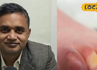 सर्दियों में होने वाली इस बीमारी को हल्के में न लें, वरना हो सकती है गंभीर, डॉक्टर से जानें लक्षण और बचाव