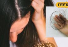 Hair Fall Prevention Tips: सर्दियों में टूटते बालों से परेशान? जरूर ट्राई करें ये खास घरेलू नुस्खे
