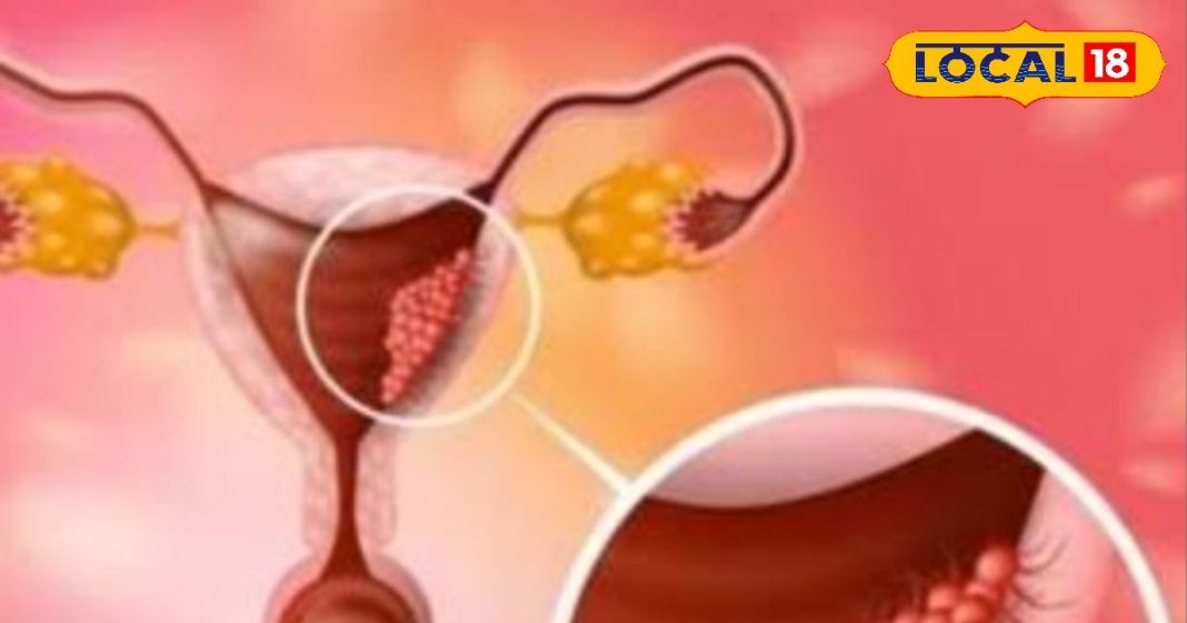 पैरों में दर्द, गिरता वजन और व्हाइट डिस्चार्ज, ये हो सकते हैं इस गंभीर बीमारी के लक्षण, महिलाएं न करें नजरअंदाज