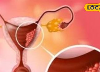 पैरों में दर्द, गिरता वजन और व्हाइट डिस्चार्ज, ये हो सकते हैं इस गंभीर बीमारी के लक्षण, महिलाएं न करें नजरअंदाज