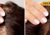 Hair Care Tips : झड़ते बालों से हैं परेशान, एक्सपर्ट से जानिए समाधान