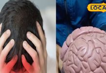Migraine Treatment: सर्दियों में माइग्रेन के दर्द से कैसे पाएं राहत, किन बातों को ध्यान में रखना जरूरी? एक्सपर्ट ने दिया सुझाव