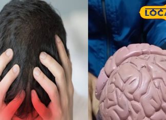 Migraine Treatment: सर्दियों में माइग्रेन के दर्द से कैसे पाएं राहत, किन बातों को ध्यान में रखना जरूरी? एक्सपर्ट ने दिया सुझाव