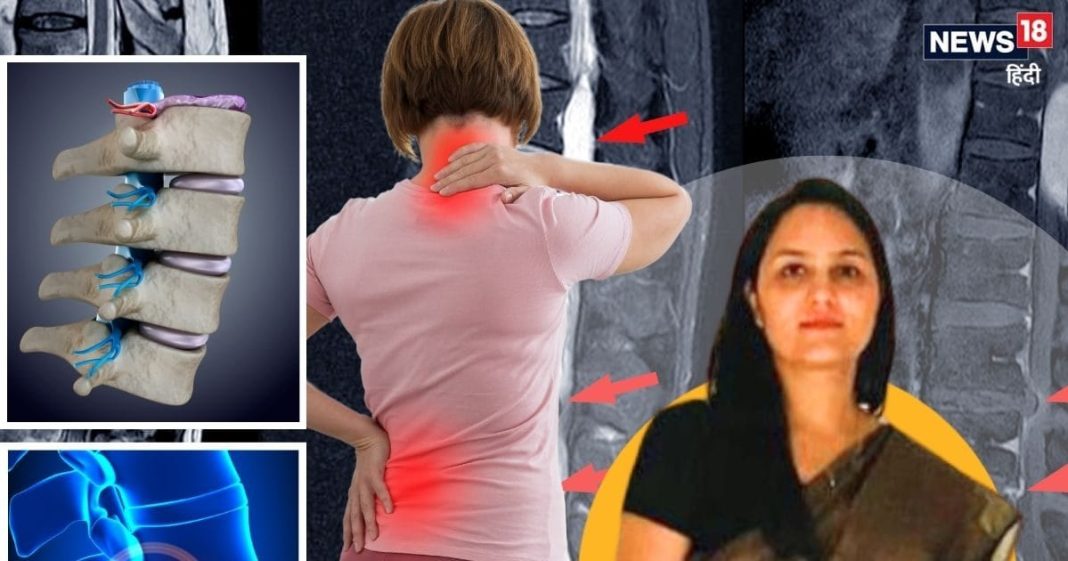 बड़ा बेदर्द है शरीर का यह दर्द, एक्ट्रेस अनुष्का शर्मा भी कर चुकीं फेस, डॉक्टर से जानें वजह, लक्षण और ट्रीटमेंट