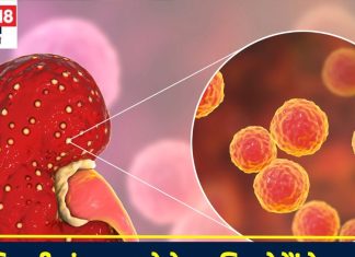 किडनी इंफेक्शन के लक्षण: जानें कारण और इलाज