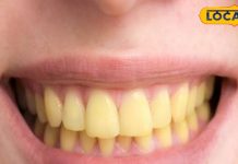 तंबाकू सिगरेट ने दांतों को कर दिया है पीला, रंगत में सुधार के लिए चबाएं ये पत्ते, चमक जाएगी बत्तीसी – Bharat.one हिंदी