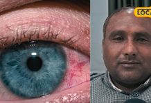 लगातार कंप्यूटर, मोबाइल देखने से होती है आंखों में जलन? आजमाएं ये देसी नुस्खे! तुरंत मिलेगी राहत
