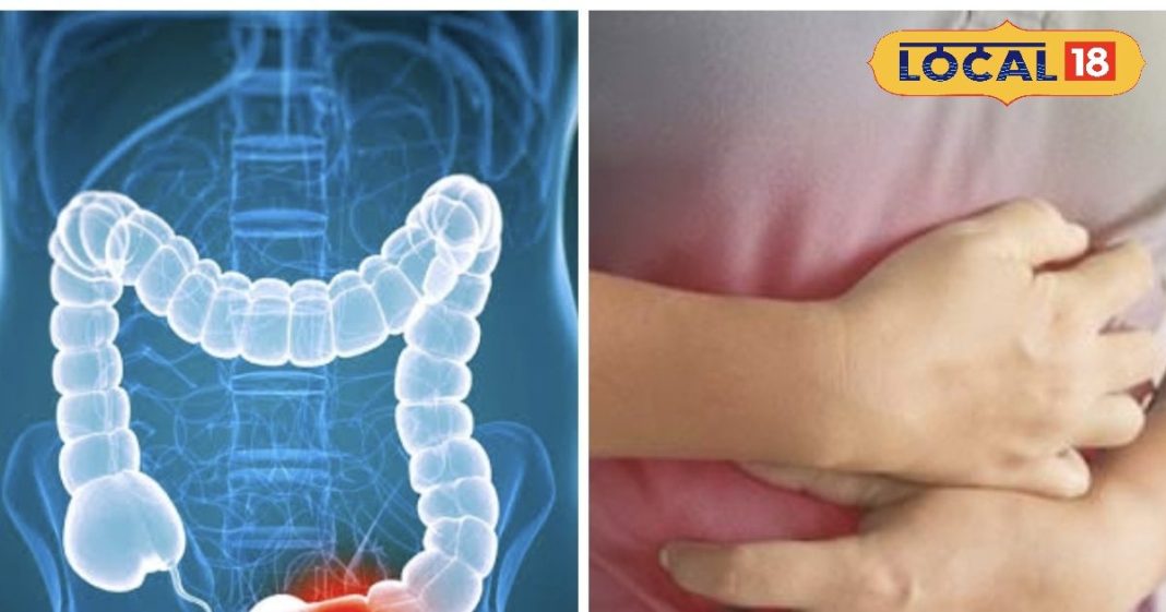 कोलोरेक्टल रोग: हैदराबाद के डॉक्टरों ने बताई समस्या की वजहें और रोकथाम.