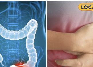 कोलोरेक्टल रोग: हैदराबाद के डॉक्टरों ने बताई समस्या की वजहें और रोकथाम.