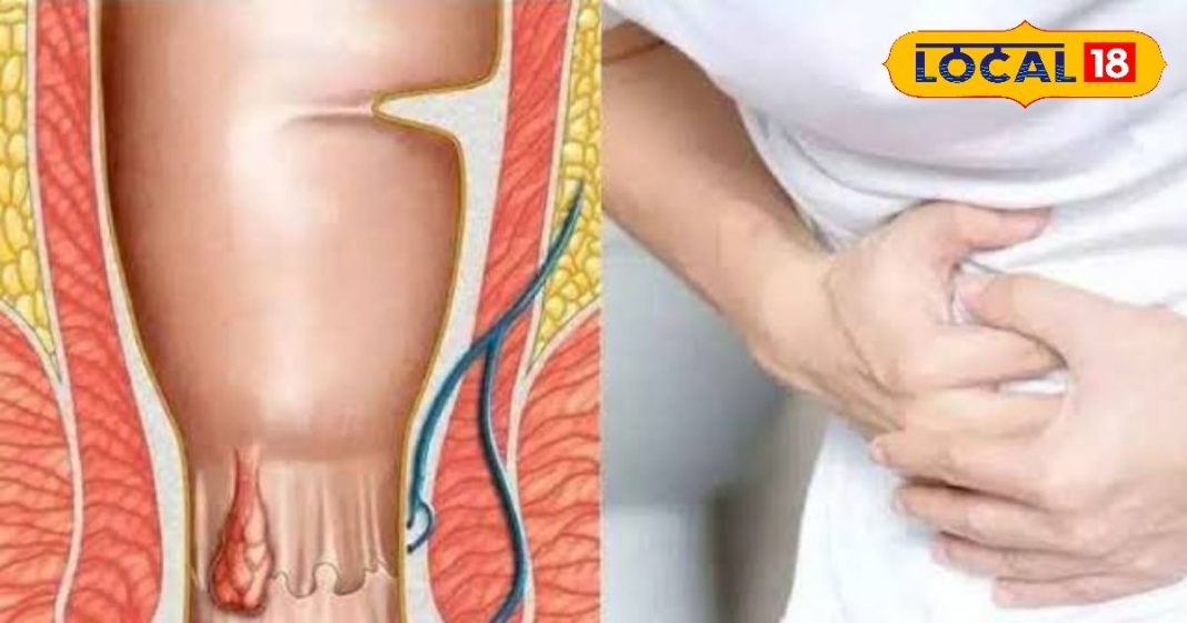 शौच में लगता है बहुत समय, होता है दर्द? ये है इस बीमारी की आहट! तुरंत करें उपाय!
