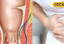 शौच में लगता है बहुत समय, होता है दर्द? ये है इस बीमारी की आहट! तुरंत करें उपाय!