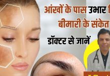 आंखों के पास इस तरह के निशान हाई कोलेस्ट्रॉल के गंभीर संकेत, कोई भारी बीमारी हो इससे पहले जान लें कार्डियोलॉजिस्ट की बात, वरना परेशानी बड़ी