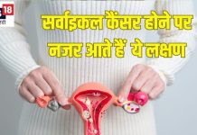 सर्वाइकल कैंसर के शुरुआती लक्षण और निदान: जानें विशेषज्ञ की राय