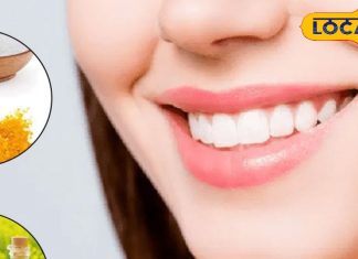 दांतों की हर परेशानी का रामबाण इलाज, इस आसान घरेलू नुस्खे से पाएं तुरंत राहत