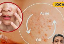 गर्मियों में चाहिए खिला-खिला चेहरा, अपनाएं ये आसान स्किन केयर टिप्स, पिंपल्स से भी मिलेगी छुटकारा