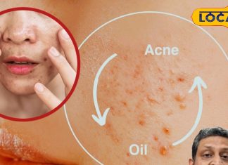 गर्मियों में चाहिए खिला-खिला चेहरा, अपनाएं ये आसान स्किन केयर टिप्स, पिंपल्स से भी मिलेगी छुटकारा