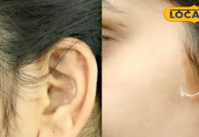 Beauty Tips : किचन में रखी इस चीज से हटाएं चेहरे के अनवांटेड हेयर, चमक उठेगी सूरत