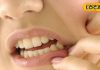 Home remedy for mouth ulcers: मुंह में हो गए हैं छाले, तो अपनाएं यह घरेलू नुस्खा, बहुत जल्दी मिलेगी आराम