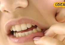Home remedy for mouth ulcers: मुंह में हो गए हैं छाले, तो अपनाएं यह घरेलू नुस्खा, बहुत जल्दी मिलेगी आराम
