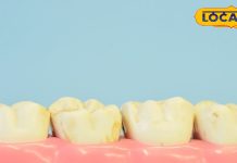Yellow Teeth Remedy: दांतों को मोतियों जैसे चमका देंगे ये 6 देसी नुस्खे, बदल जाएगी बत्तीसी की रंगत