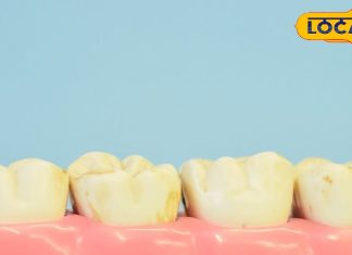 Yellow Teeth Remedy: दांतों को मोतियों जैसे चमका देंगे ये 6 देसी नुस्खे, बदल जाएगी बत्तीसी की रंगत