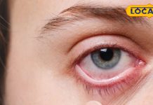 Summer Eye Care Tips: गर्मियों में आंखों को इंफेक्शन से बचाने के लिए जरूर फॉलो करें डॉक्टर की ये जरूरी टिप्स!